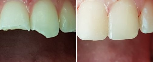 conservativa dentale